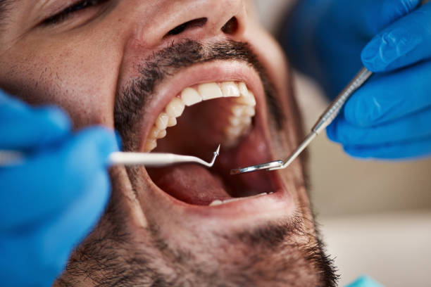 Best Emergency Tooth Extraction in Bradner, OH