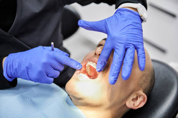 Best Emergency Dental Care for Broken or Chipped Teeth in Bradner, OH